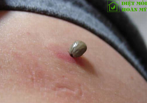 Ve chó có cắn người không?