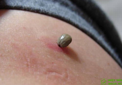 Ve chó có ký sinh trên người không?