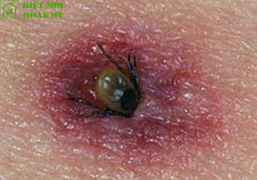 Ve chó có lây sang người không?