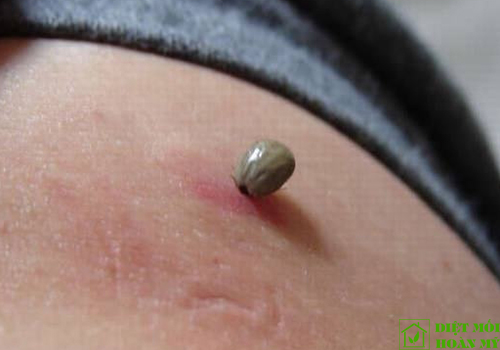 Ve chó và cách trị