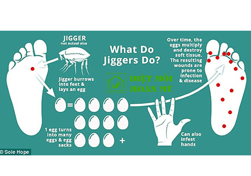 Bọ chét ký sinh trên người