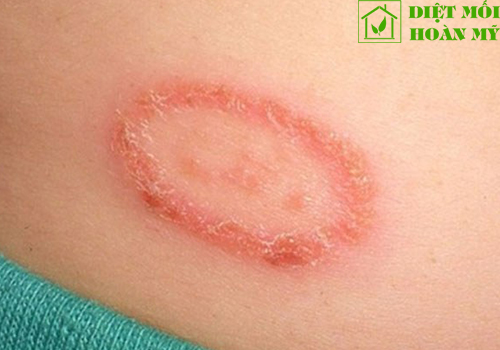 Kiến ba khoang bay