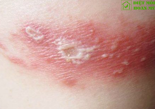 Kiến ba khoang đuôi nhọn