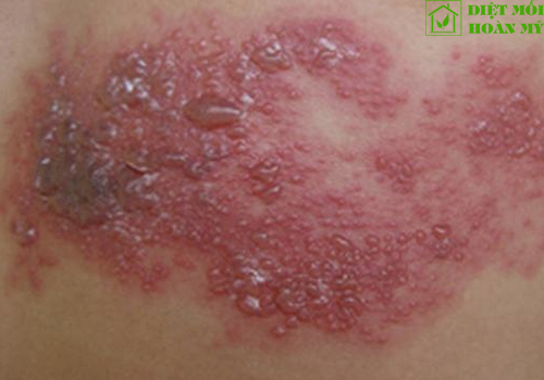 Kiến ba khoang là gì?