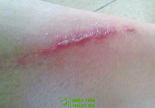 Kiến ba khoang nhỏ