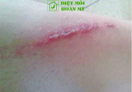 Loài kiến ba khoang