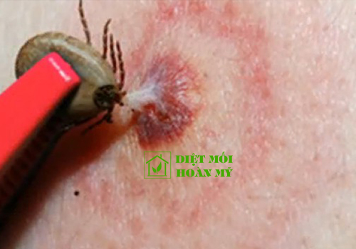 Ve chó có hút máu người không?