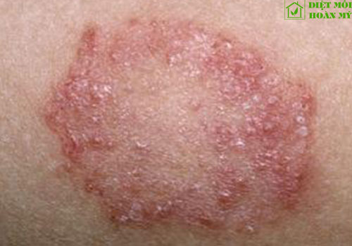 Cách xử lý kiến ba khoang cắn