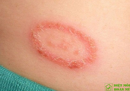 Cách xử lý và tiêu diệt kiến ba khoang