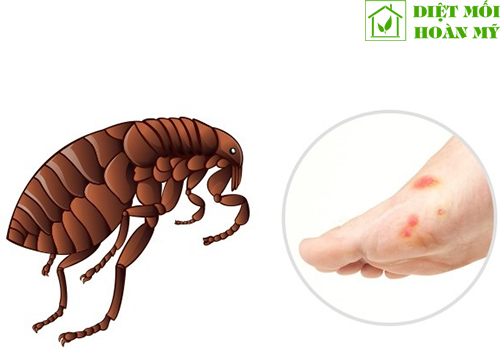 Bị bọ chét cắn phải làm sao?