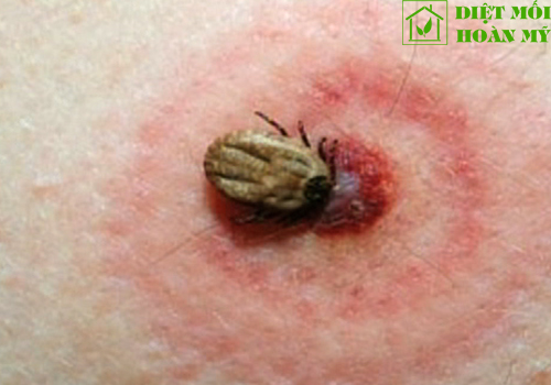 Ve chó có cắn người không?