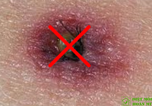 Ve chó và cách trị