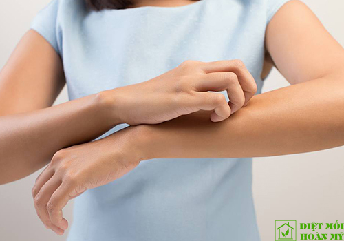 Cách trị rệp giường cắn